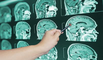 Brain Hemorrhage Detection Brain Hemorrhage Detection